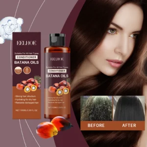 Batana Oil Shampoo Conditioner Set Oil Control Anti Dandruff Scalp Hair Treatment